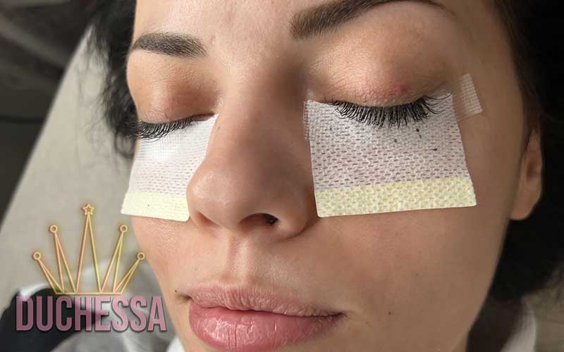 SVILENE TREPAVICE NOVI SAD